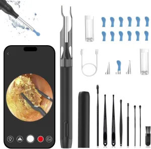 Ear Wax Removal Tool Camera Ear Tweezers with Camera, Ear Camera Wax Removal, 10 Megapixels Ear Otoscope Camera, Ear Cleaner with Camera for Ear Cleaning (Black)